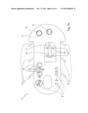 Transport device for ossicular prosthesis diagram and image