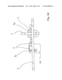 Transport device for ossicular prosthesis diagram and image