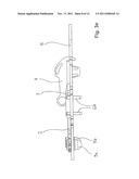 Transport device for ossicular prosthesis diagram and image