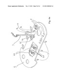 Transport device for ossicular prosthesis diagram and image