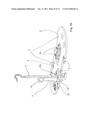 Transport device for ossicular prosthesis diagram and image