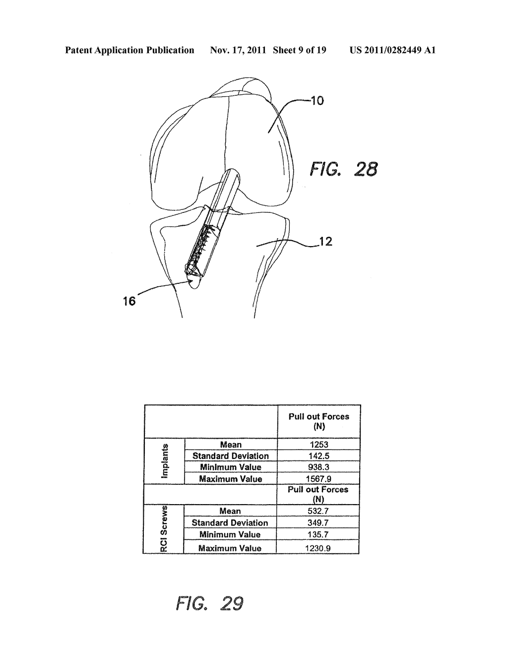 DEVICES, SYSTEMS, AND METHODS FOR MATERIAL FIXATION - diagram, schematic, and image 10