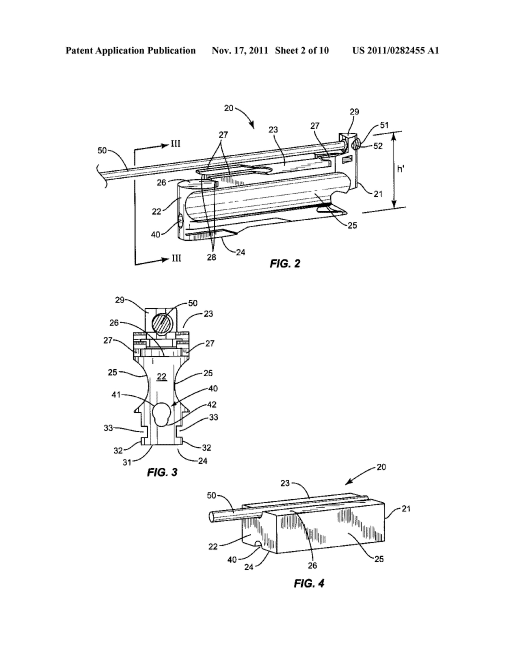 Stackable Intervertebral Devices and Methods of Use - diagram, schematic, and image 03