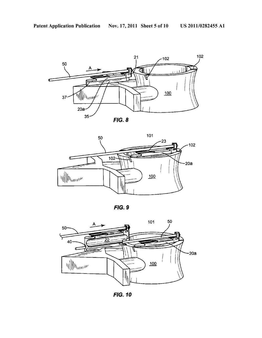 Stackable Intervertebral Devices and Methods of Use - diagram, schematic, and image 06