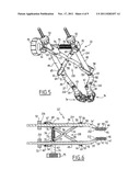 CONNECTABLE INTERBODY IMPLANT diagram and image