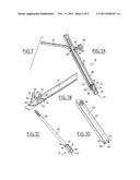 CONNECTABLE INTERBODY IMPLANT diagram and image