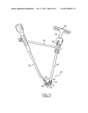 CONNECTABLE INTERBODY IMPLANT diagram and image