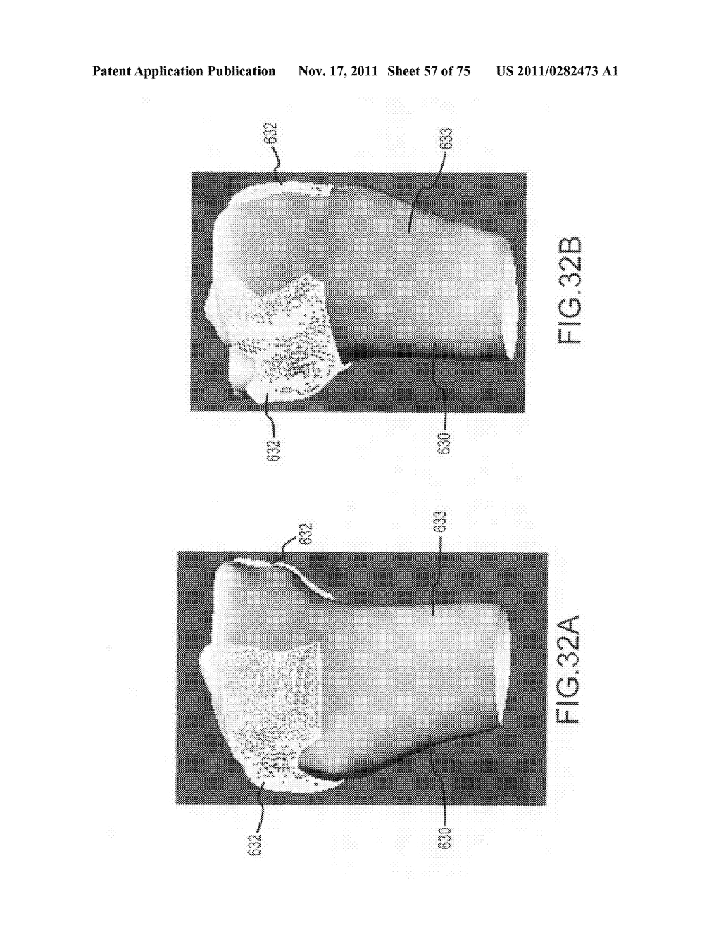 System and method for image segmentation in generating computer models of     a joint to undergo arthroplasty - diagram, schematic, and image 58