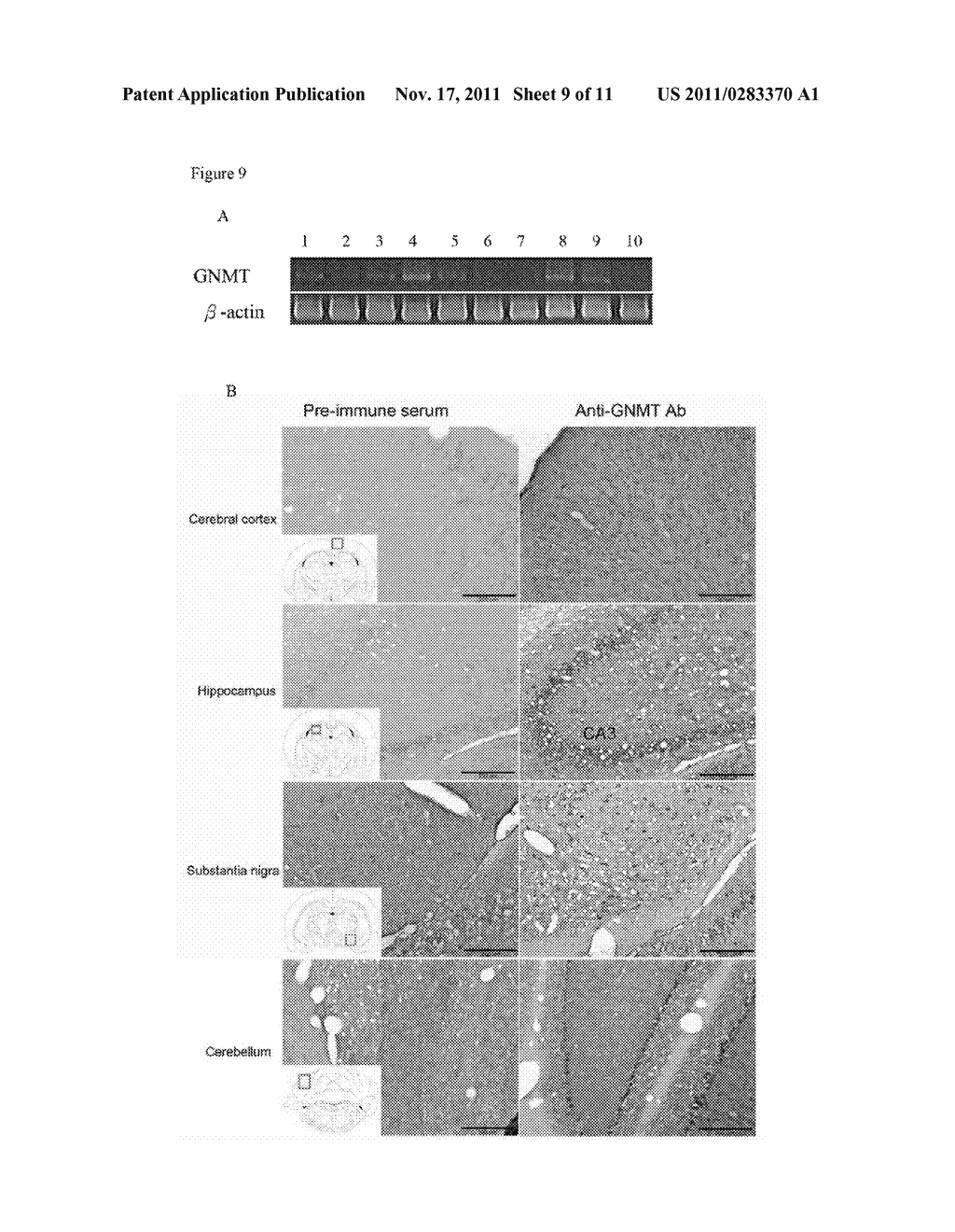 MOUSE MODEL FOR DEPRESSION, SCHIZOPHRENIA AND ALZHEIMER'S DISEASE AND THE     USE THEREOF - diagram, schematic, and image 10