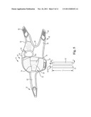 WRIST GUARD WITH STIFFENER ELEMENTS diagram and image