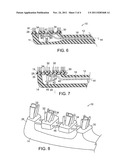 TOOTHBRUSH WITH POWERED HEAD diagram and image