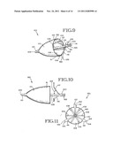 REMOVABLE ANCHORED LUNG VOLUME REDUCTION DEVICES AND METHODS diagram and image