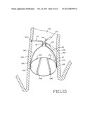 REMOVABLE ANCHORED LUNG VOLUME REDUCTION DEVICES AND METHODS diagram and image