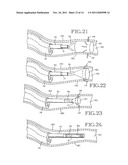 REMOVABLE ANCHORED LUNG VOLUME REDUCTION DEVICES AND METHODS diagram and image