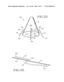 REMOVABLE ANCHORED LUNG VOLUME REDUCTION DEVICES AND METHODS diagram and image