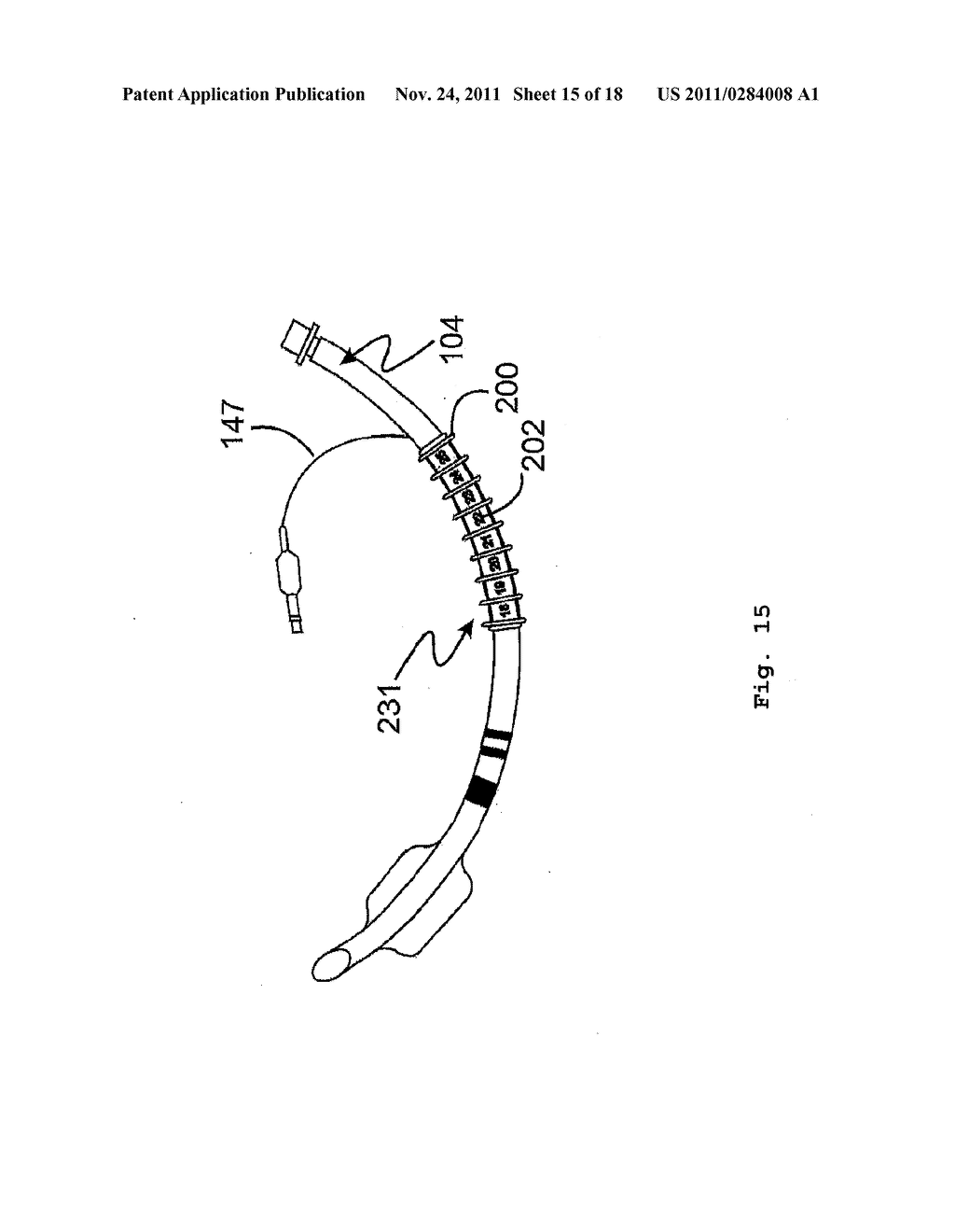 COMPLETE AIRWAY STABILIZATION SYSTEM - diagram, schematic, and image 16