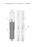 Tension/Collar/Reamer Assemblies And Methods diagram and image