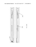 Tension/Collar/Reamer Assemblies And Methods diagram and image