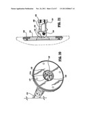 RAISED BOSS FOR STAPLE GUIDE diagram and image