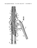 RAISED BOSS FOR STAPLE GUIDE diagram and image