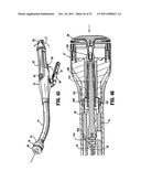 RAISED BOSS FOR STAPLE GUIDE diagram and image