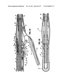 RAISED BOSS FOR STAPLE GUIDE diagram and image