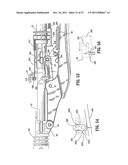 RAISED BOSS FOR STAPLE GUIDE diagram and image