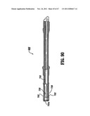 RAISED BOSS FOR STAPLE GUIDE diagram and image