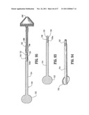 RAISED BOSS FOR STAPLE GUIDE diagram and image