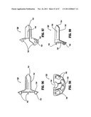 RAISED BOSS FOR STAPLE GUIDE diagram and image