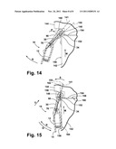 LATCH ASSEMBLY, OVER-CENTER REVERSE DRAW diagram and image