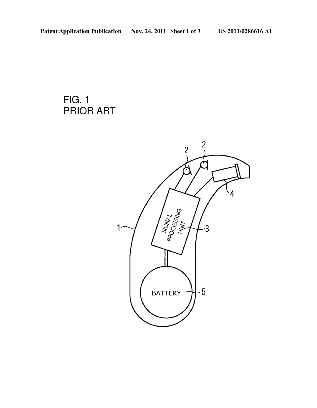 HEARING DEVICE WITH A PASSIVE UNIT SEATED DEEP IN THE AUDITORY CANAL - diagram, schematic, and image 02