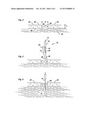 ICE ANCHOR SYSTEM diagram and image