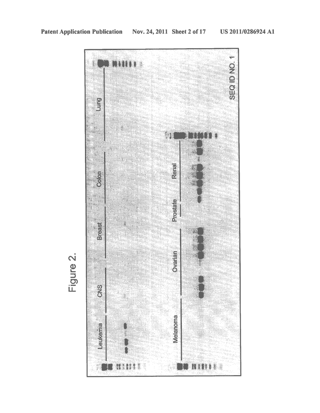 NOVEL HUMAN ENDOGENOUS RETROVIRAL ERV3 VARIANT AND USES THEREOF IN THE     DIAGNOSING OVARIAN CANCER - diagram, schematic, and image 03