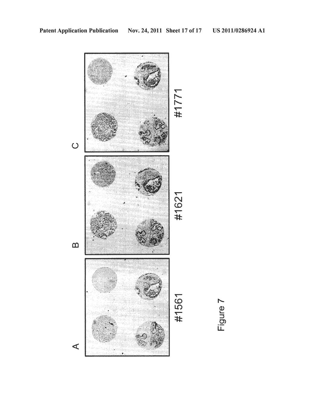 NOVEL HUMAN ENDOGENOUS RETROVIRAL ERV3 VARIANT AND USES THEREOF IN THE     DIAGNOSING OVARIAN CANCER - diagram, schematic, and image 18