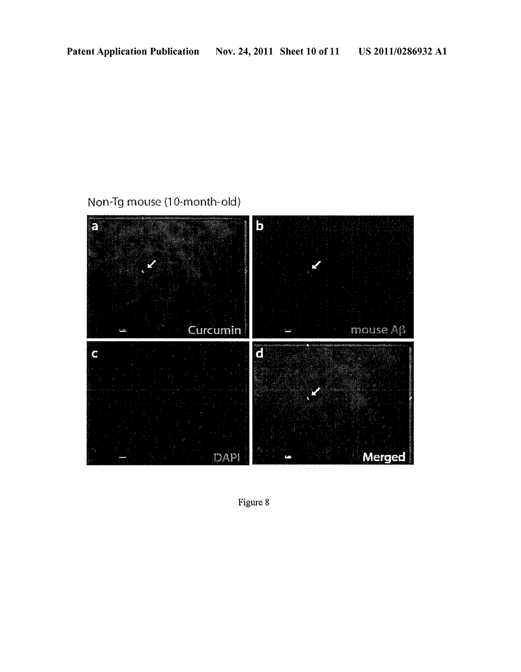 OPTICAL METHOD FOR THE DETECTION OF ALZHEIMER'S DISEASE - diagram, schematic, and image 11