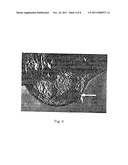 METHODS FOR INTRODUCING HETEROLOGOUS CELLS INTO FISH diagram and image