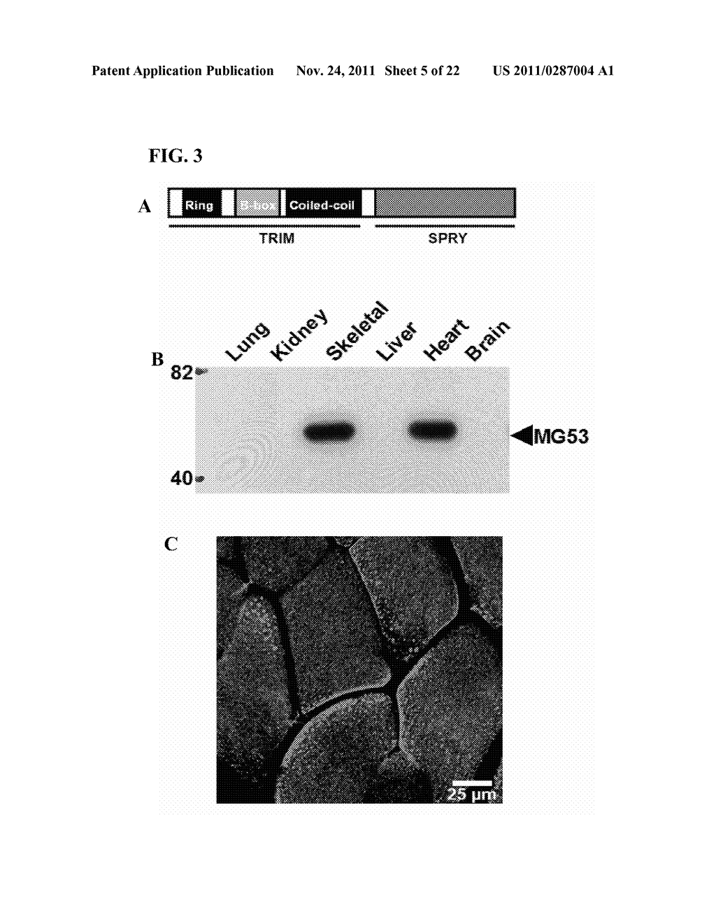 MG53 COMPOSITIONS AND METHODS OF USE - diagram, schematic, and image 06