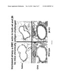 Treatment and Prevention of Chronic Asthma Using Antagonists of Integrin     AlphavBeta6 diagram and image