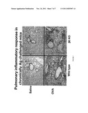 Treatment and Prevention of Chronic Asthma Using Antagonists of Integrin     AlphavBeta6 diagram and image