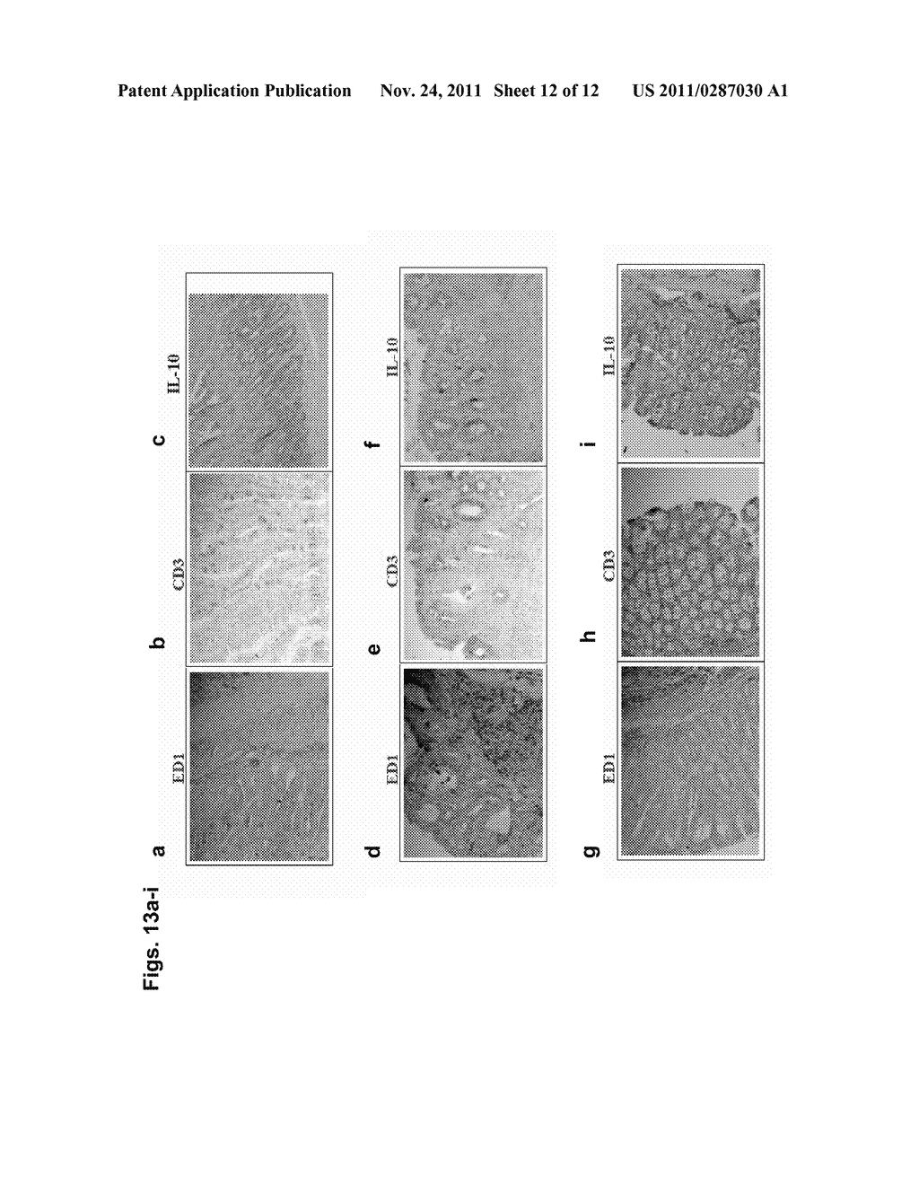 COMPOSITIONS AND METHODS FOR DIAGNOSING AND TREATING AN INFLAMMATION - diagram, schematic, and image 13