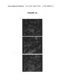 USE OF FERRITIN TO TREAT IRON DISORDERS diagram and image