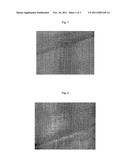 MEDICAL PRODUCT FOR TREATING STENOSIS OF BODY PASSAGES AND FOR PREVENTING     THREATENING RESTENOSIS diagram and image