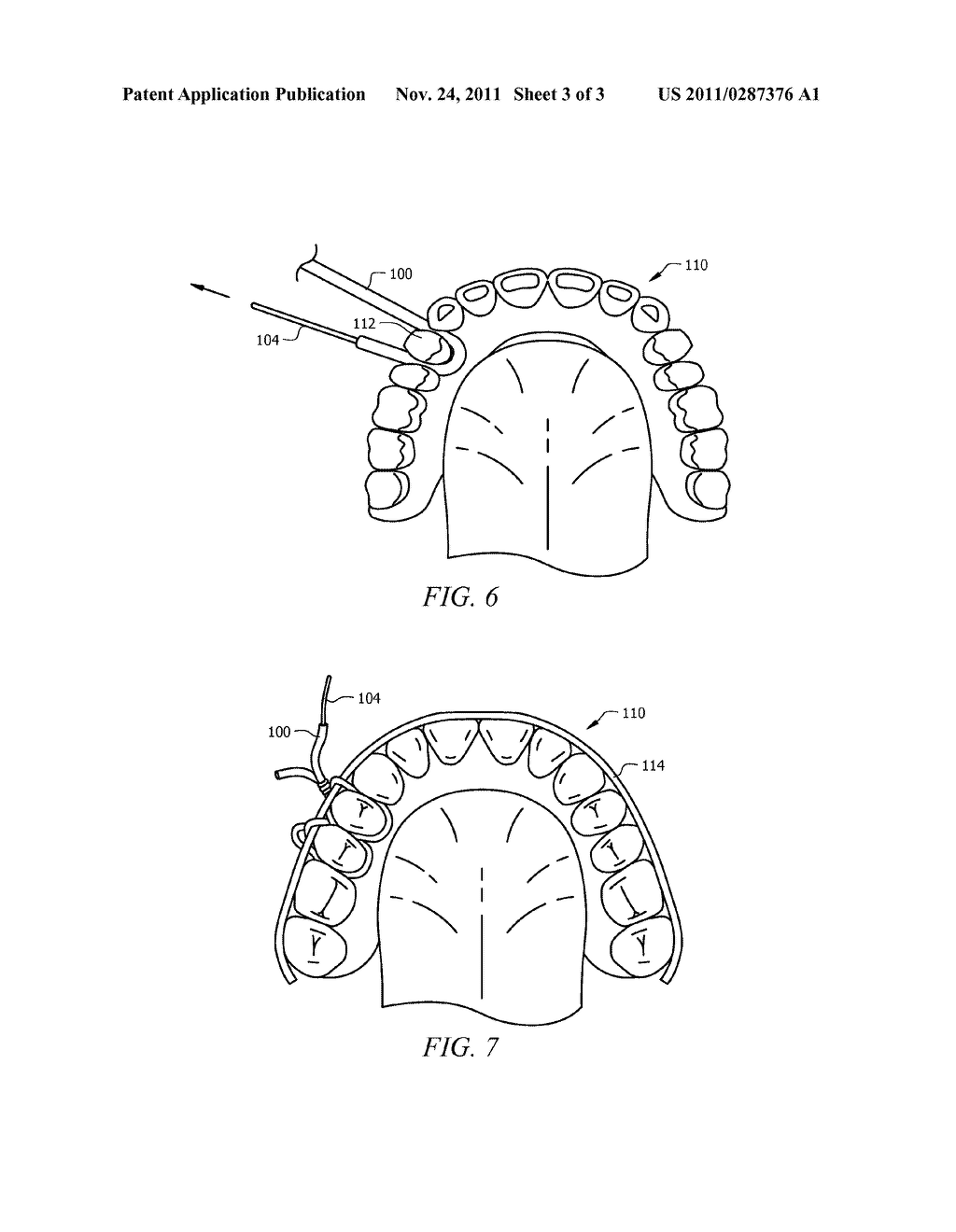 Device For Circumdental Wiring Intraoral Objects And Related Oral     Structures - diagram, schematic, and image 04