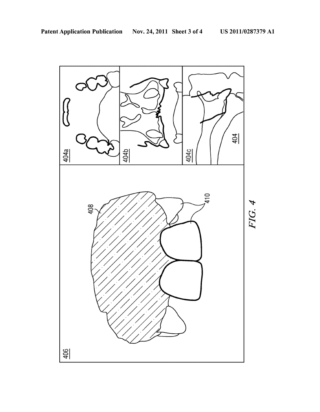 Display method and system for enabling an operator to visualize and     correct alignment errors in imaged data sets - diagram, schematic, and image 04