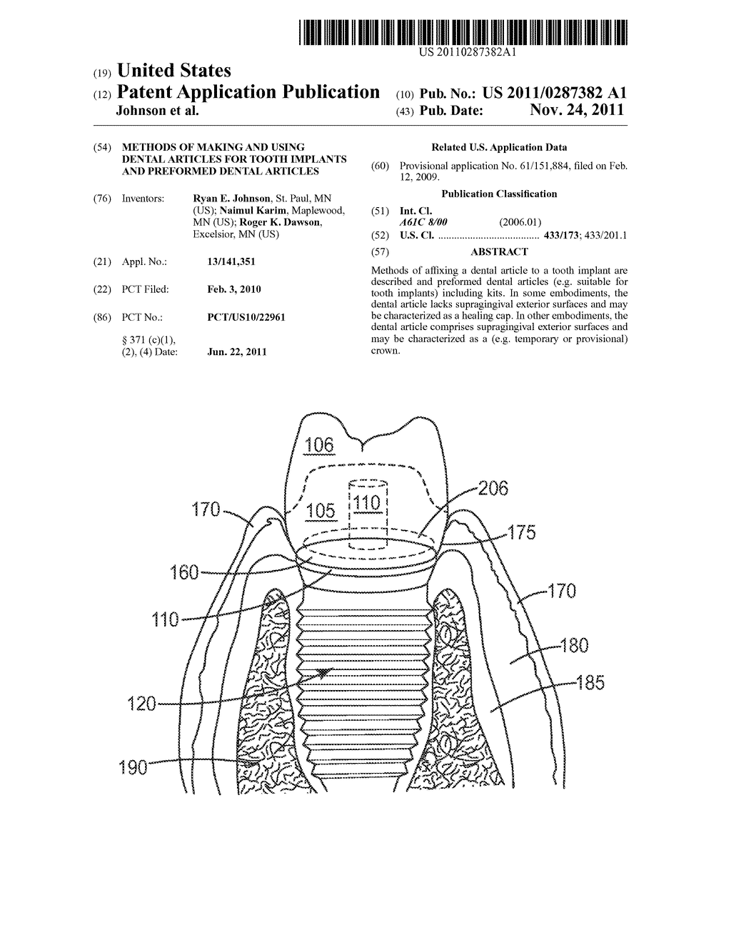 METHODS OF MAKING AND USING DENTAL ARTICLES FOR TOOTH IMPLANTS AND     PREFORMED DENTAL ARTICLES - diagram, schematic, and image 01