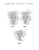 DENTAL IMPLANT diagram and image