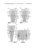 DENTAL IMPLANT diagram and image