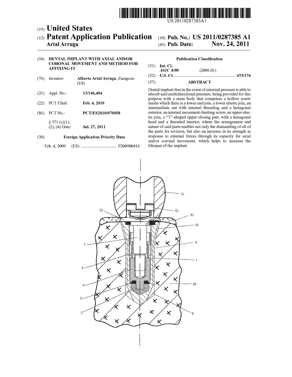 DENTAL IMPLANT WITH AXIAL AND/OR CORONAL MOVEMENT AND METHOD FOR AFFIXING     IT - diagram, schematic, and image 01