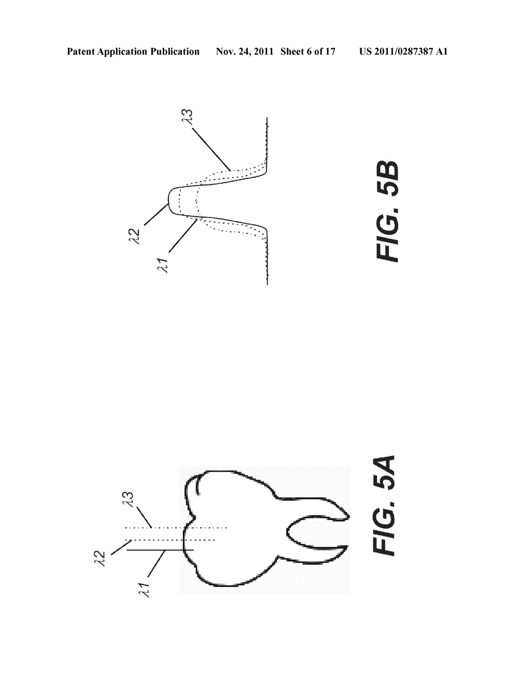 SYSTEM AND METHOD FOR DETECTING TOOTH CRACKS - diagram, schematic, and image 07